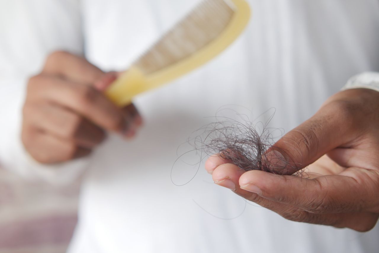 What Percentage of Men Go Bald? Hair Loss Facts and Statistics What Percentage of Men Go Bald? Hair Loss Facts and Statistics